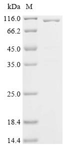 Recombinant Rabies virus Glycoprotein (G), partial, Biotinylated