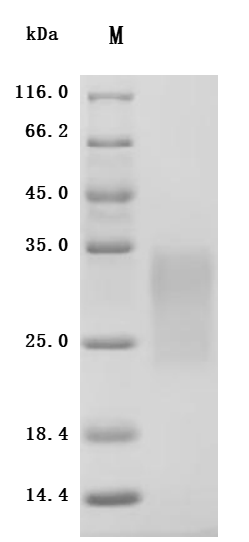 Recombinant Human Activin receptor type-2B (ACVR2B), partial (Active)