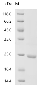 Recombinant Mouse Prolactin (Prl)