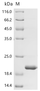 Recombinant Macaca fascicularis Kidney associated antigen 1