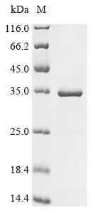 Recombinant Human SUN domain-containing protein 3 (SUN3), partial