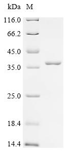 Recombinant Mycobacterium bovis Diacylglycerol acyltransferase/mycolyltransferase Ag85B (fbpB)