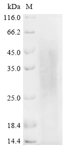 Recombinant Human L-lactate dehydrogenase A chain (LDHA)