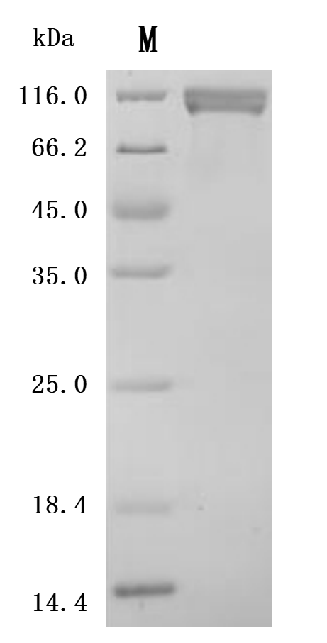 Recombinant Macaca fascicularis Protein tyrosine kinase 7 (PTK7), partial (Active)