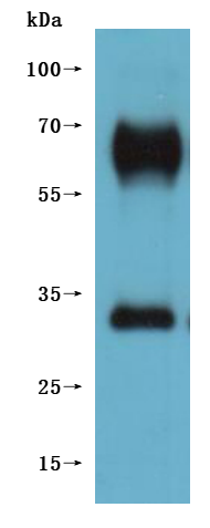 Recombinant Macaca fascicularis G protein-coupled receptor 20 (GPR20)-VLPs (Active)