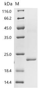 Recombinant Human Claudin-1 (CLDN1)