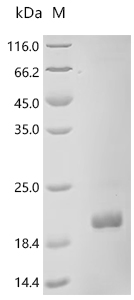 Recombinant PRRSV HB-2 (sh)/2002 ORF2b structual protein, partial