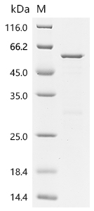 Recombinant Human Z-DNA-binding protein 1 (ZBP1)