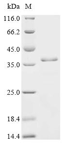 Recombinant Paramacrobiotus richtersi Cytosolic-abundant heat soluble protein 106094 (CAHS 106094)