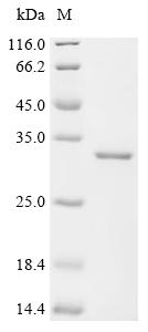 Recombinant Human Ferritin heavy chain (FTH1) (C103A)