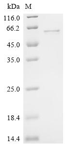 Recombinant Human Z-DNA-binding protein 1 (ZBP1)
