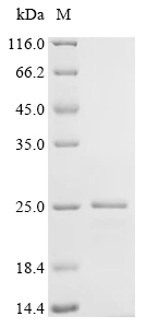 Recombinant Cricetulus griseus Uncharacterized protein