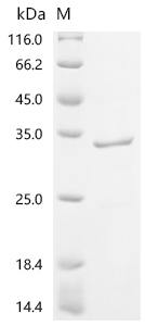 Recombinant Human Pulmonary surfactant-associated protein A1 (SFTPA1)