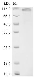 Recombinant Human NAD-dependent protein deacetylase sirtuin-1 (SIRT1)
