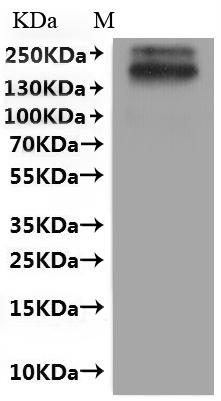 Recombinant Human Sodium/glucose cotransporter 2 (SLC5A2)-VLPs