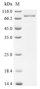 Recombinant Human Adipocyte plasma membrane-associated protein (APMAP), partial