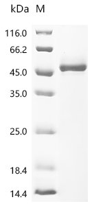 Recombinant Human Interleukin-4 (IL4) (Active)