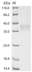 Recombinant Mouse CD276 antigen (Cd276), partial