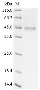 Recombinant Human CAD protein (CAD), partial