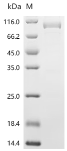 Recombinant Human Endogenous retrovirus group K member 6 Env polyprotein (ERVK-6), partial
