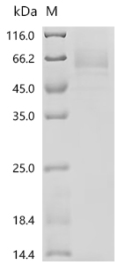 Recombinant Human Endogenous retrovirus group K member 6 Env polyprotein (ERVK-6), partial
