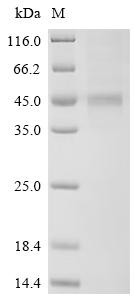 Recombinant Human Interleukin-20 receptor subunit beta (IL20RB), partial
