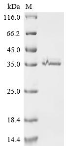 Recombinant Human Retinaldehyde-binding protein 1 (RLBP1)