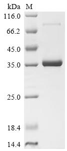 Recombinant Human Lymphocyte antigen 6E (LY6E)