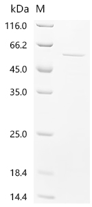 Recombinant Human Casein kinase II subunit beta (CSNK2B)