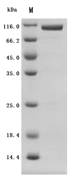Recombinant Human Inactive tyrosine-protein kinase 7(PTK7), partial (Active)