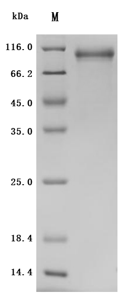 Recombinant Rat Cadherin-6(Cdh6), partial (Active)