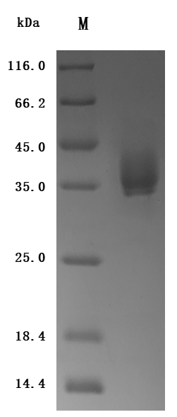 Recombinant Human Tissue factor(F3), partial (Active)