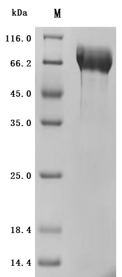 Recombinant Human Mucin-13(MUC13), partial (Active)
