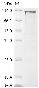Recombinant Human NAD-dependent protein deacetylase sirtuin-1 (SIRT1)