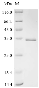 Recombinant Sheep Fibroblast growth factor 2 (FGF2)