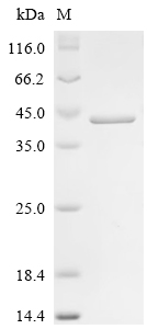 Recombinant Human LIM and SH3 domain protein 1 (LASP1)