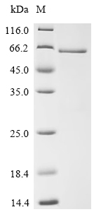 Recombinant Human Interferon regulatory factor 3 (IRF3)