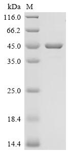Recombinant Human Retinaldehyde-binding protein 1 (RLBP1)