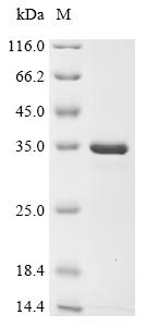 Recombinant Human Beta-crystallin B3 (CRYBB3)