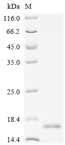 Recombinant Human Lymphocyte antigen 6E (LY6E)