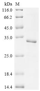Recombinant Human Transcriptional enhancer factor TEF-1 (TEAD1), partial