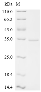 Recombinant Human Appetite-regulating hormone (GHRL), Partial