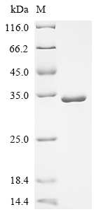 Recombinant Macaca fascicularis Superoxide dismutase [Cu-Zn](SOD1)