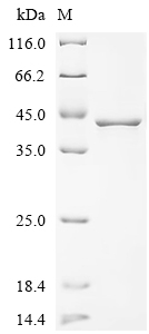 Recombinant Human L-lactate dehydrogenase A chain(LDHA)