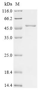 Recombinant Human Ubiquitin carboxyl-terminal hydrolase 21 (USP21), partial
