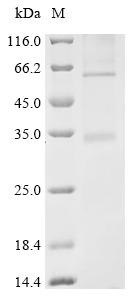 Recombinant Human Succinate receptor 1 (SUCNR1)