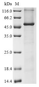 Recombinant Human Acyl-CoA 6-desaturase (FADS2)