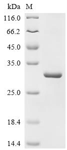 Recombinant Human G/T mismatch-specific thymine DNA glycosylase (TDG), partial