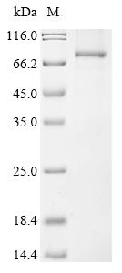 Recombinant Human ATP-dependent RNA helicase DHX33 (DHX33)
