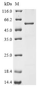 Recombinant Measles virus Hemagglutinin glycoprotein (H) , partial, Biotinylated